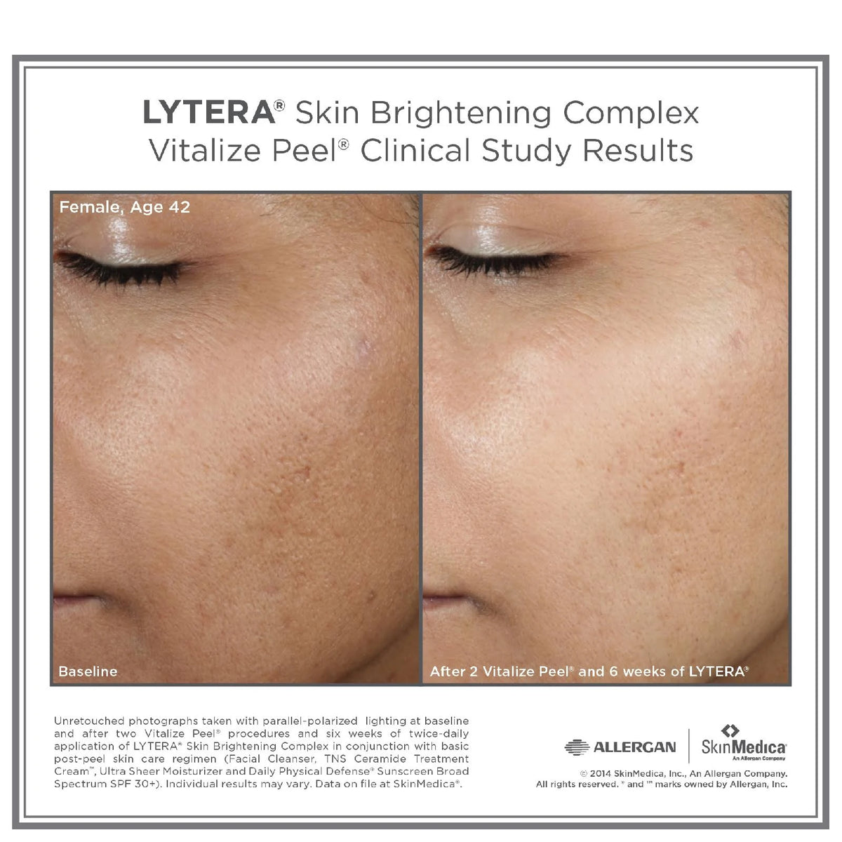 Skin Brightening Complex 2 oz F792776