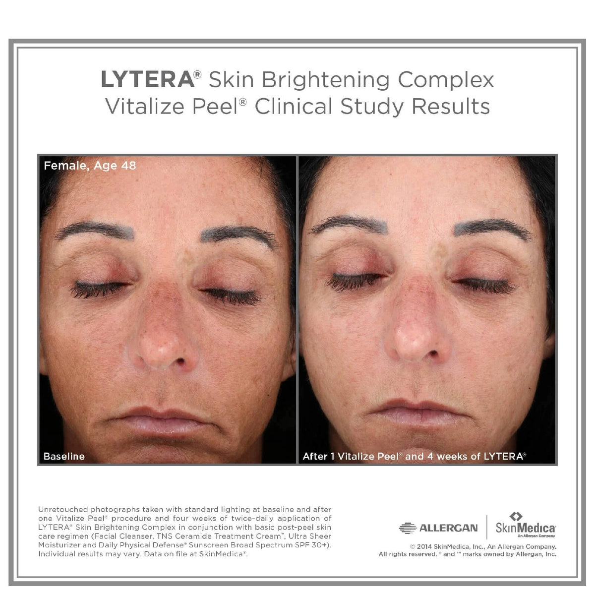 Skin Brightening Complex 2 oz F792776