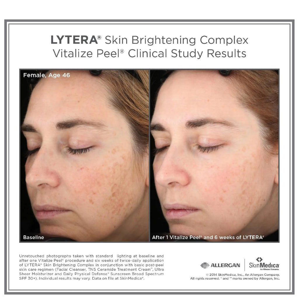 Skin Brightening Complex 2 oz F792776