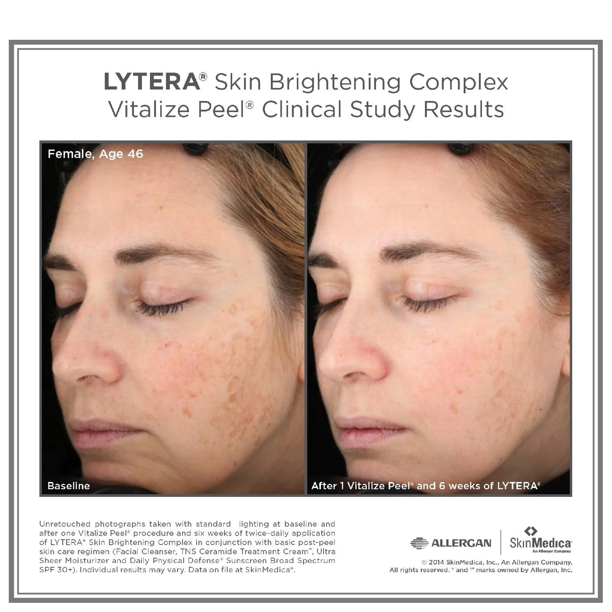 Skin Brightening Complex 2 oz F792776